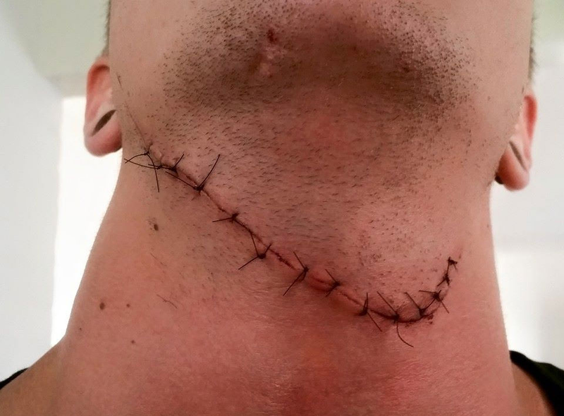Illustration for article titled Counter-Strike Player Survives Having His Throat Cut